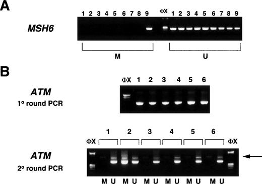 Fig. 6. (A) Single-step methylation-specific PCR is shown for theMSH6 locus. Lanes 1, 3, 4, 6, and 7: samples from patients in acute-phase CML; lanes 2 and 5: samples from patients in chronic phase CML; lane 8: normal donor buffy-coat DNA; lane 9: normal donor buffy-coat DNA treated in vitro with CpG methylase (SssI methylase). M, primers specific for methylated DNA; U, primers specific for unmethylated DNA; ◊x, ◊x/HaeIII marker. (B) Two-step methylation-specific PCR for the ATM promoter region. In the first round, the CpG island is amplified from bisulfite-modified DNA using primers that are insensitive to methylation (see Materials and Methods). In the second round, primers specific for methylated DNA (M) or unmethylated DNA (U) are used in PCR together with a small amount of template from the first reaction (arrow). Lane 1: normal donor buffy-coat DNA; lane 2: normal donor buffy-coat DNA treated in vitro with CpG methylase (SssI methylase); lanes 3 through 6: samples from patients in acute-phase CML. ◊x, ◊x/HaeIII marker.
