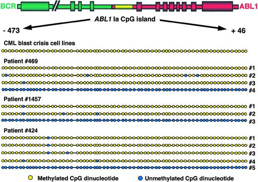 Fig. 5. Methylation topology of the ABL1 promoter region. The region amplified corresponds to coordinates −473 to +46 with respect to the start of exon 1a or coordinates 37352 to 37871 of GenBank sequence U07563.42 The relative position of dots on the diagram corresponds to the relative position of CpG dinucleotides along the island. Yellow dots indicate methylated CpG dinucleotides; blue dots indicate unmethylated CpG dinucleotides. Amplification products obtained from total peripheral blood and/or bone marrow mononuclear cells were cloned and individual clones were sequenced on a fluorescent sequencer. The designation “CML blast crisis cell lines” refers to cell lines EM2, BV173, and KBM5. Patients 469 and 1457 were in accelerated-phase CML when samples were collected and patient 424 was in blast crisis. For each patient, several clones of methylated DNA are depicted alongside a representative clone of unmethylated DNA.