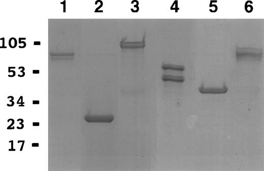 Fig. 2. SDS-PAGE of recombinant purified proteins. 1: GST-calreticulin; 2: GST; 3: MBP-calreticulin; 4: calreticulin cleaved from MBP-calreticulin; 5: MBP; 6: MBP–▵120-calreticulin.