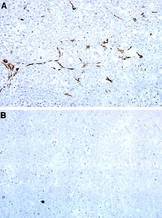 Fig. 9. Immunohistochemical detection of the tumor vasculature in representative Burkitt tumors treated with MBP or MBP-calreticulin. Paraffin-embedded tumor sections were stained with mouse anti-alpha smooth muscle actin monoclonal antibody and counterstained with hematoxylin. (A) Representative tumor tissue from a mouse treated with MBP alone. (B) Representative tumor tissue from mouse treated with MBP-calreticulin (original magnification ×20).