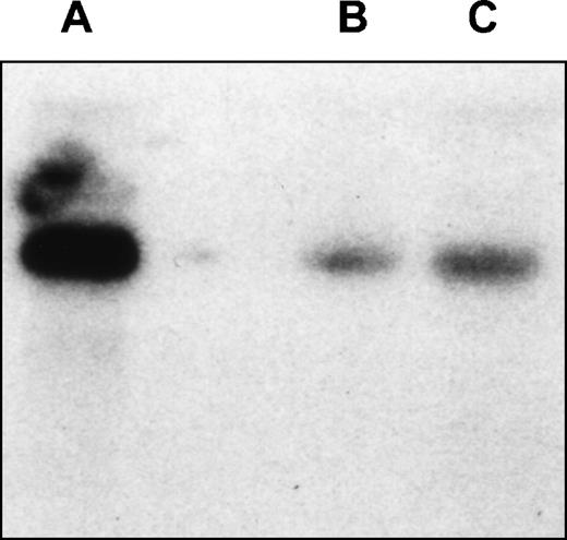 Fig. 4. Northern analysis of EphA3 expression in LK63hi and 293T cell lines. Hybridization of the membrane with EphA3 cDNA probe. The probe spans 61 bp to 1,692 bp of EphA3 cDNA and shows a 7-kb transcript in both cell lines. (A) LK63 mRNA; (B) 293T total RNA; (C) 293TmRNA.