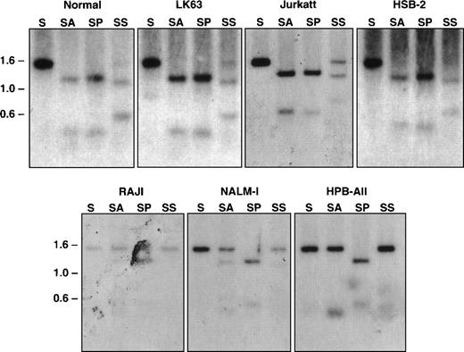 Fig. 6. Southern blot analysis of the 5′ region of the EphA3 gene in normal human peripheral blood and tumor cell lines. Samples shown in the top panel all express the EphA3 gene and samples shown in the bottom panel are EphA3 negative. LK63 and Nalm-1 are pre-B cell lines and Raji is a B-cell line. Jurkatt, HSB-2, and HPB-ALL are T-cell lines. Genomic DNA (10 μg) from each sample was digested withSacI (S), or double digested with SacI and AvaI (SA), SacI and PvuII (SP), and SacI andSacII (SS). AvaI and SacII are methyl-sensitive restriction enzymes. Digests were incubated overnight at 37°C, run on a 1% agarose gel, and transferred to a Zetaprobe membrane. The membrane was hybridized with the 1.4-kb SacI genomic fragment containing the EphA3 promoter.