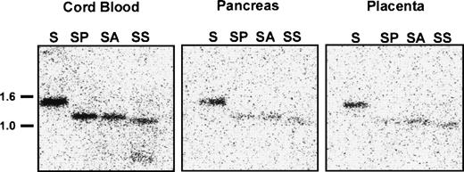 Fig. 8. Southern blot analysis of the 5′ region of the EphA3 gene in normal human samples of lymphocytes and monocytes isolated from cord blood, adult pancreas, and placental tissues. Genomic DNA (10 μg) from each sample was digested withSacI (S) or double digested with SacI and AvaI (SA), SacI and PvuII (SP), and SacI andSacII (SS). AvaI and SacII are methyl-sensitive restriction enzymes. The Southern blot was hybridized with the 1.4-kbSacI genomic fragment containing the EphA3 promoter.