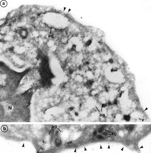 Fig. 3. Subcellular localization of PR3 by electron microscopy on neutrophils thin frozen sections labeled with anti-PR3. Electron micrograph of resting neutrophils from the same individual stained for localization of PR3 with the MoAb anti-PR3 CLB 12.8 followed by incubation with 10-nm gold particles-conjugated goat antimouse (GAM 10). (a) Gold-labeled antibody is present at the periphery of large extracted granules identified as the azurophil granules (ag) as well as in the membrane of intracellular empty vesicles (v). Plasma membrane labeling is shown by arrow heads (original magnification × 35,200). (b) The immunogold label (arrowheads) indicates the presence of PR3 on the plasma membrane in a random distribution head (original magnification × 42,550).