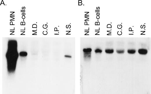 Fig. 1. Northern blot analysis of p67-phox and gp91-phox mRNA transcripts. Each lane contained 10 μg of total cellular RNA from normal neutrophils (PMN) or EBV-B cells from a normal control or from the indicated patients. The figure shows a blot probed with 32P-labeled full-length p67-phox cDNA (A) and then stripped and reprobed with gp91-phox cDNA (B).
