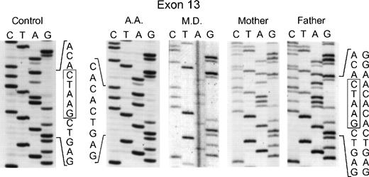 Fig. 3. Sequence analysis of PCR-amplified exon 13 of the p67-phox gene from genomic DNA. In the two left panels are the sequences of a normal control and patient AA. The right three panels show patient MD and her parents. Boxes indicate the 5 nts in the normal sequence that are deleted in the mutated alleles. The 5′ end of the DNA is at the top of each sequencing panel.
