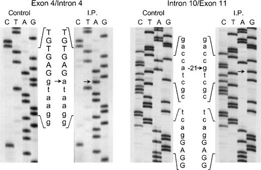 Fig. 4. Sequence analysis of the exon 4/intron 4 and intron 10/exon 11 regions of the p67-phox gene amplified by PCR using genomic DNA from patient IP and a normal control. The exonic sequences are represented by capital letters, while the intronic sequences are indicated by lower case letters. Arrows indicate transitions of g → a at position +1 of intron 4 and of a → g at position −21 of the branch point sequence of intron 10. The 5′ end of the DNA is at the top of each sequencing panel.