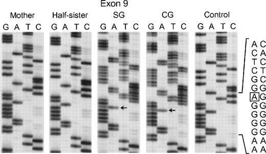 Fig. 7. Sequence analysis of PCR-amplified exon 9 of the p67-phox gene from genomic DNA from patients SG and CG, their mother, half-sister (maternal), and a normal control. The box in the normal sequence indicates the adenine that is deleted in SG and CG, with only normal sequence seen in the mother and maternal half-sister. The 3′ end of the DNA is at the top of each sequencing panel.