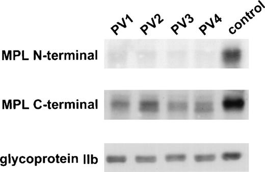 Fig. 1. C-terminal antiserum detects Mpl in PV platelets. PV and control platelet lysates were probed with an antiserum against the N-terminus and one against the C-terminus of Mpl. The membrane was reprobed with an antiserum against glycoprotein IIb to control for equal loading of platelet protein.