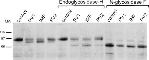 Fig. 4. Specific and nonspecific endoglycosidase digestion of control and PV platelet lysates. Platelet lysates from a control and 3 different patients were untreated (lanes 1 to 4), digested with endoglycosidase H (lanes 5 to 8), or digested with N-glycosidase F (lanes 9 to 12), and subsequently probed with the Mpl C-terminal antiserum.