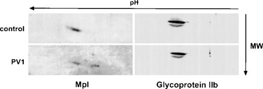 Fig. 5. Two-dimensional electrophoresis analysis of glycoprotein IIb in control and PV platelets. Platelet lysates from a control (upper panels) and a PV patient (lower panels) were analyzed by 2-dimensional gel electrophoresis and immunoblotted with the Mpl C-terminal antiserum (left) or antiserum to glycoprotein IIb (right).