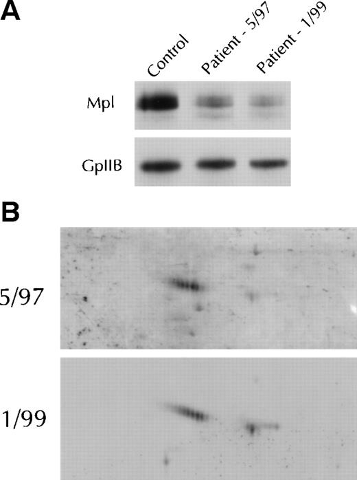 Fig. 6. Mpl isoform evolution in a single patient. (A) Immunoblots after 1-dimensional electrophoresis of patient platelet lysate obtained at diagnosis in May 1997 and again in January 1999 were probed with the Mpl C-terminal antiserum. The immunoblot was reprobed with the glycoprotein IIb antiserum to verify equal protein loading. (B) Two-dimensional gel electrophoresis of the platelet lysates shown in (A) were probed with the C-terminal antiserum.
