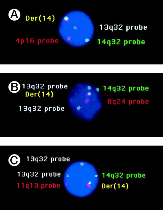 Fig. 1. (A) Photograph of a malignant PC with t(4;14) and deletion 13q. The 4p16 (FGFR3) probe is labeled in red, whereas the 14q32 probes (Ig10 and 158A2) are labeled in green and the 13q32 probe in white/grey. The t(4;14) is represented by the fusion signal and the normal chromosomes 4 and 14 by the red and green signals, respectively. Only 1 white signal is observed, reflecting deletion 13q. (B) A plasma cell of a patient with t(8;14)(q24;q32). The translocation is identified by the fusion of 1 green (14q32 probe) and 1 red (8q24) signal. The separated green and red signals correspond to the normal chromosomes 14 and 8, respectively. Finally, this patient did not display chromosome 13 monosomy, because 2 white signals (13q32 probe) were observed. (C) Translocation t(11;14)(q13;q32), not associated with monosomy 13, in a patient with multiple myeloma. The fusion of 1 green (14q32 probe) and 1 red (11q13 probe) signal corresponds to the derivative chromosome 14, whereas the separated green and red signals represent normal chromosomes 14 and 11, respectively. Two white signals (13q32 probe) are observed.