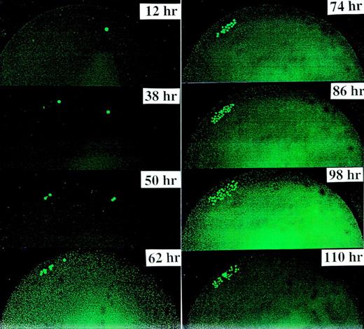 Fig. 1. This figure demonstrates a typical symmetric division of one CD34+/CD38− cell derived from FLV. We found that the first cell division occurred consistently at 36 to 38 hours after culturing. Thereafter, the cell doubling time was 12 hours. Previous and subsequent experiments with shorter observation intervals (eg, every 3 hours) have demonstrated that cells might migrate, partly due to movements of the culture plates and partly due to the migratory property of the progenitor cells themselves.