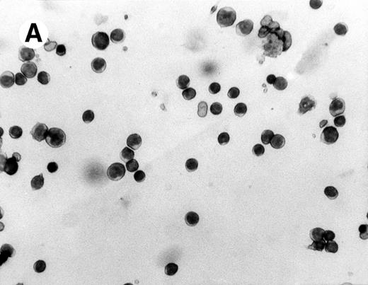 Fig. 2. Histomorphological changes in spleen and liver from 6-month-old Fas-deficient mice. Cytospin preparations and liver imprints were stained with May-Grünwald-Giemsa. (A) Normal splenocytes; (B) splenocytes from Fas-deficient mice; (C) normal liver imprints; (D) liver imprints from Fas-deficient mice. Original magnification × 300.
