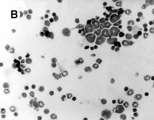 Fig. 2. Histomorphological changes in spleen and liver from 6-month-old Fas-deficient mice. Cytospin preparations and liver imprints were stained with May-Grünwald-Giemsa. (A) Normal splenocytes; (B) splenocytes from Fas-deficient mice; (C) normal liver imprints; (D) liver imprints from Fas-deficient mice. Original magnification × 300.