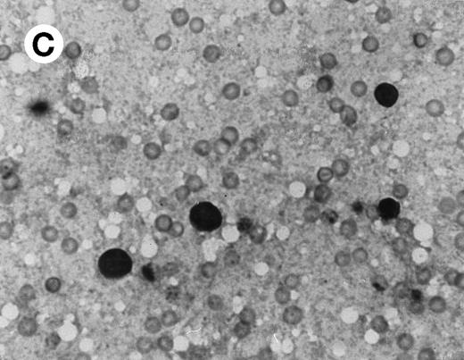 Fig. 2. Histomorphological changes in spleen and liver from 6-month-old Fas-deficient mice. Cytospin preparations and liver imprints were stained with May-Grünwald-Giemsa. (A) Normal splenocytes; (B) splenocytes from Fas-deficient mice; (C) normal liver imprints; (D) liver imprints from Fas-deficient mice. Original magnification × 300.