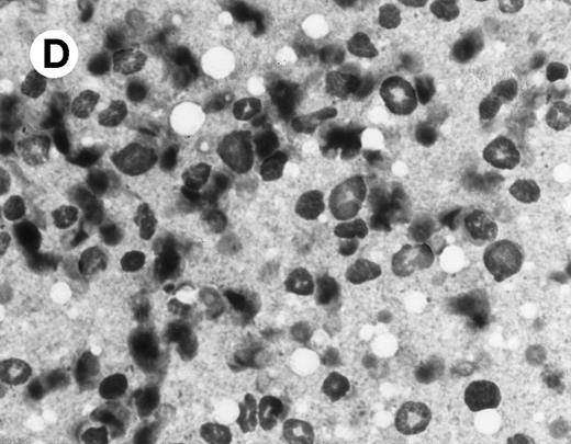 Fig. 2. Histomorphological changes in spleen and liver from 6-month-old Fas-deficient mice. Cytospin preparations and liver imprints were stained with May-Grünwald-Giemsa. (A) Normal splenocytes; (B) splenocytes from Fas-deficient mice; (C) normal liver imprints; (D) liver imprints from Fas-deficient mice. Original magnification × 300.