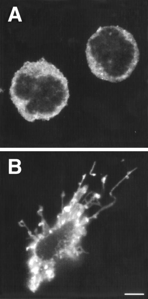 Fig. 2. Morphology and phenotype of thymic DC precursors freshly isolated and after in vitro stimulation with IL-3. For confocal laser scanning microscope analysis, CD1a−CD3−CD4+CD8−thymocytes were sorted and either directly cytocentrifuge preparations were made or cells were cultured for 5 days in the presence of IL-3, resuspended and layered on precoated glass slides. Both fresh and cultured cells were stained for HLA-DR. For FACS analysis, CD1a−CD3−CD4+CD8−thymocytes were cultured for 5 days in the presence of IL-3 and CD40L+ mouse fibroblasts. (A) Freshly isolated DC precursors show a rounded morphology and weak staining for HLA-DR. (B) Activated DCs upon culture in IL-3 acquire a dendritic morphology and more intense staining for HLA-DR (bar, 5 μm). (C) IL-3– and CD40L-activated DCs display a phenotype specific for mature DC. (D) The expression of IL-3R and IL-7R on thymic DC precursors compared with CD4 ISP pre-T cells. Solid lines represent staining with specific antibodies as compared with staining with isotype-matched controls indicated with dotted lines.