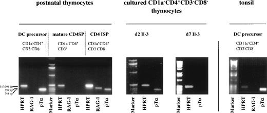 Fig. 6. Thymic and tonsillar DC precursors express mRNA for pT. Thymic DC precursors, CD4 ISP, mature CD4 SP thymocytes, and tonsillar DC precursors were analyzed for expression of mRNA for HPRT, pT, and RAG-1. pT mRNA expression was also determined for thymic DC precursors cultured for 2 and 7 days with IL-3.