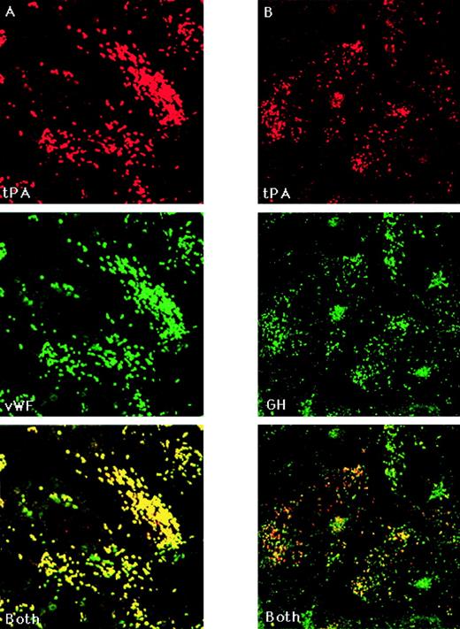 Fig. 4. Colocalization of tPA with vWF and GH. (A) tPA versus vWF. Uninfected HUVEC were fixed, permeabilized, and stained with biotinylated sheep anti-tPA antibody followed by rhodamine-conjugated avidin and then FITC-conjugated goat anti-vWF. (B) tPA versus GH. GHrAd-infected HUVEC were fixed, permeabilized, and stained with biotinylated sheep anti-tPA and rabbit anti-GH antibodies, followed by rhodamine-conjugated avidin and then FITC-conjugated antirabbit antibody. Scanning confocal microscopy images were obtained at 0.36-μm intervals in the Z-axis using a 100× objective. Shown are representative scans from the approximate midsection of the Z-axis. The red and green images were merged to demonstrate colocalization, which appears yellow.