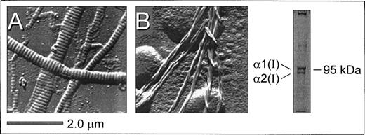 Fig. 1. Structural features of native insoluble and plasmin-solubilized type I collagen as a representative example. Native, insoluble fibrillar type I collagen (from bovine achilles tendon) and pepsin-solubilized type I collagen (from human placenta) were coated on glass coverslips as described in Materials and Methods. Surface replication analysis of insoluble type I collagen (A) showed a characteristic banded pattern that was noticeably absent from the smaller fibrils derived from pepsin-solubilized type I collagen (B), where microfibril assemblies displayed a nonbanded spiraled configuration. Polyacrylamide gel electrophoresis under denaturing and nonreducing conditions showed the presence of the 1(I) and 2(I) type I collagen subunits as well as high molecular weight multimers (right).