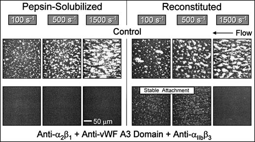 Fig. 6. Role of distinct collagen receptors in mediating platelet attachment under flow to reconstituted (banded) and pepsin-solubilized (nonbanded) type I collagen. Blood was perfused through the parallel plate chamber as described in the legend to Fig 2. Control blood or blood containing monoclonal antibodies to block specifically the function of platelet 2β1 and IIbβ3 concurrently with inhibition of plasma vWF binding to collagen was perfused over pepsin-solubilized (nonbanded) type I collagen or reconstituted collagen derived from the former, as indicated. Note the complete inhibition of platelet interaction with pepsin-solubilized (nonbanded) collagen when platelet 2β1 and IIbβ3function were blocked concurrently with inhibition of plasma vWF binding to collagen, compared with the stable attachment of single platelets at 100 s−1 and 500 s−1 under the same conditions with reconstituted type I collagen. Representative images of 6 separate experiments with blood from different donors are shown.
