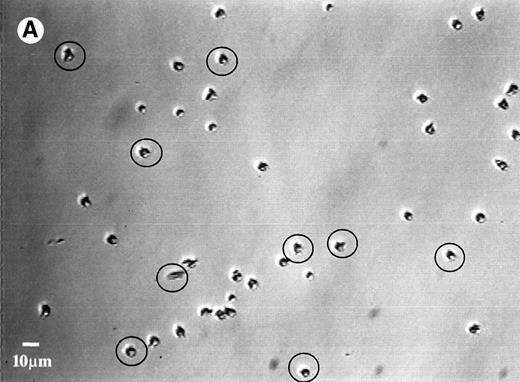 Fig. 5. Photomicrographs of the neutrophil distribution on the SO3 preadsorbed with HK (A) before and (B) after buffer flushing at a shear rate of 240 s−1. Circled areas indicate regions where cell detachment had taken place.