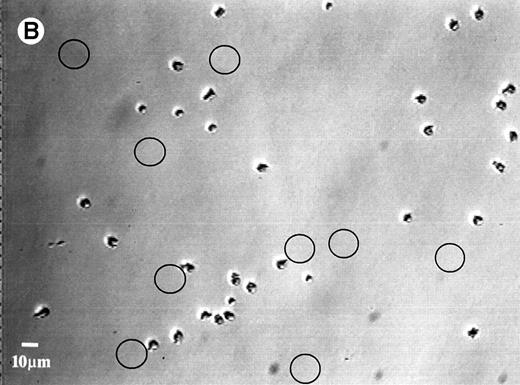 Fig. 5. Photomicrographs of the neutrophil distribution on the SO3 preadsorbed with HK (A) before and (B) after buffer flushing at a shear rate of 240 s−1. Circled areas indicate regions where cell detachment had taken place.