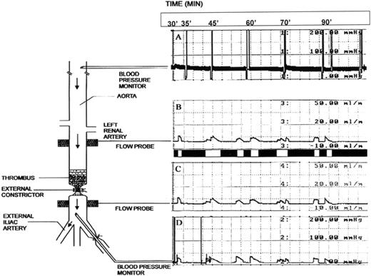 Fig. 1. Schematic representation of the rabbit thrombolysis model. A thrombus, formed from rabbit whole blood, is depicted superimposed on a stenosis in a denuded and damaged segment of the aorta. The external constrictor, by itself, restricts blood flow by at least 66%, reducing the flow from 15 mL/min to 3 to 5 mL/min, thereby producing a critical stenosis. Blood flow is not observed after production of the thrombus. The spatial relationship of both the blood pressure and flow probes with respect to the thrombus is indicated. To the right of the schematic representation of the rabbit are tracings from both blood pressure and flow probes, which indicate a representative recording of cyclic flow observed during treatment with tPA and PTI.