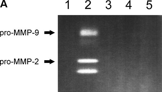 Fig. 1. (A) MMP-2 and MMP-9 induction by fibronectin. CEM T cells were cultured on several extracellular matrix proteins for 24 hours. The figure shows the zymographic pattern of concentrated conditioned medium of 107 cells plated on polylysine (lane 1), fibronectin (lane 2), laminin-1 (lane 3), type-I collagen (lane 4), and type-IV collagen (lane 5). (B) Accumulation of MMP-2 and MMP-9 in the conditioned medium over time. 107 cells were incubated on plastic or on fibronectin for different periods of time. The conditioned medium was concentrated and subjected to gelatin zymography. The figure shows the gelatinolytic signal quantified as described in the Materials and Methods section. (C) CEM cells produce activated forms of MMP-2 in response to fibronectin. Unconcentrated conditioned medium obtained from HUVEC confluent monolayers cultured on plastic was subjected to gelatin zymography in the absence (−) or in the presence (+) of p-aminophenylmercuric acetate (APMA). Concentrated conditioned medium from 107 CEM cells cultured on fibronectin (Fn) for 24 hours disclosed an identical zymographic pattern.