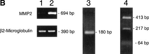 Fig. 2. (A) Western blot identification of MMP-2 in CEM-conditioned medium. Gelatin affinity-purified–conditioned medium from 108 CEM cells cultured for 24 hours on plastic (P) or in the presence of soluble fibronectin at 10 μg/mL (Fn) was subjected to Western blot analysis with the MoAb Ab-3 against MMP-2. (B) RT-PCR demonstration of MMP-2 transcripts in CEM cells. PCR-amplified cDNA obtained from resting CEM cells (lane 1) and CEM cells exposed to fibronectin at 10 μg/mL for 4 hours (lane 2). Simultaneous amplification of the housekeeping gene β2-microglobulin is shown to ensure an equivalent amount of template in both conditions. Lane 3 shows the nested PCR product obtained from the 694 bp fragment using previously published internal primers.22 Lane 4 shows the Sac I restriction fragments of the 694 bp fragment.