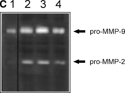 Fig. 3. (A) Inhibition of fibronectin-induced MMP-2 and MMP-9 by blocking MoAb against integrin chains. 107 CEM cells per condition were preincubated with medium alone or with MoAb against 4, 5, and V integrin chains (fibronectin receptors); 6 integrin chain (a laminin receptor); or the anti-CD20 93.1B3 (a B-cell lineage marker) before exposure to fibronectin. Conditioned medium was concentrated and subjected to gelatin zymography. Graph shows variation in gelatinolytic signals compared with the signal obtained with untreated cells exposed to fibronectin. (B) Membrane-associated MMP-2 expression induced by fibronectin-derived synthetic peptides. CEM cells were exposed to GRGDSPC, EILDVSPT, a combination of both, or to the control peptide GRGES at 100 μg/mL for 16 hours. Histograms show distribution of fluorescence intensity in 5 × 103 cells per condition incubated with the MoAb Ab-3 recognizing MMP-2. (C) Pro-MMP-2 and pro-MMP-9 production stimulated by fibronectin-derived synthetic peptides. 2 × 107 CEM cells were cultured on plastic (lane 1) or on plastic coated with GRGDSPC (lane 2), EILDVSPT(lane 3), or both (lane 4) at 100 μg/mL. The conditioned medium obtained after 48 hours was concentrated and subjected to gelatin zymography.