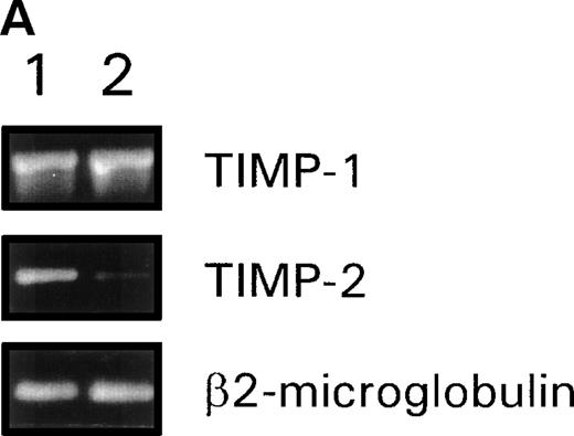 Fig. 4. (A) RT-PCR analysis of TIMP-1 and TIMP-2 mRNA levels in CEM cells stimulated with fibronectin. cDNA obtained from resting CEM cells (lane 1) or stimulated with soluble fibronectin at 10 μg/mL for 4 hours (lane 2). β2-microglobulin amplification is used to control template quantity in each condition. (B) Membrane expression of TIMP-1 and TIMP-2 in CEM cells treated with fibronectin-derived peptides. Flow cytometry analysis of CEM cells cultured with a combination of GRGDSPC and EILDVSPT in solution at 100 μg/mL for 16 hours. The peptide GRGES was used as control. Histograms show distribution of fluorescence intensity in 5 × 103 cells per condition.