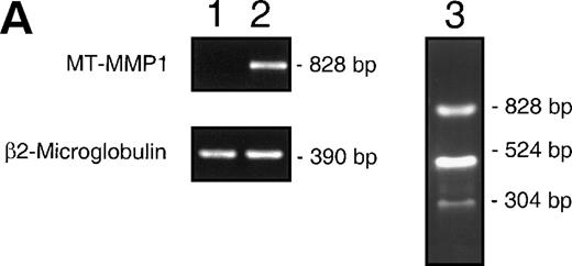 Fig. 5. (A) Induction of MMP-14 expression in CEM cells by fibronectin. MMP-14 (MT1-MMP) transcripts obtained from baseline CEM cells (lane 1) and CEM cells exposed to fibronectin (10 μg/mL) for 4 hours (lane 2). Concomitant amplification of β2-microglobulin shows equivalent amounts of template in both samples. Lane 3 shows the Nco I restriction fragments of the 828 bp PCR product. (B) Surface expression of MMP-14 induced by fibronectin-derived peptides in CEM cells. CEM cells were incubated with either GRGDSPC, EILDVSPT, a combination of both, or the control peptide GRGES at 100 μg/mL for 16 hours and subjected to flow cytometry. Histograms show fluorescence intensity distribution among 5 × 103 cells immunostained with the polyclonal antibody Ab-2 recognizing MMP-14.