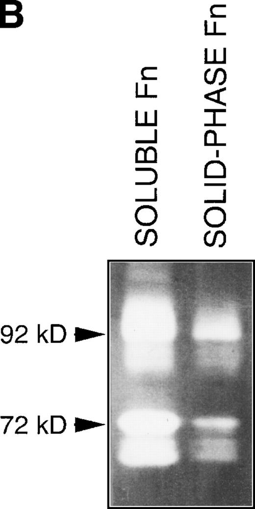 Fig. 6. (A) Changes in fibronectin-induced MMP-2 and MMP-9 production achieved by manipulating integrin-mediated signal transduction pathways. 107 CEM cells were exposed to the above-described chemicals 30 minutes before exposure to fibronectin. Conditioned medium was obtained after 6 hours, concentrated, and subjected to gelatin zymography. Graph shows the variation in the intensity of the fibronectin-induced gelatinolytic signal induced by treatment with the different products and their simultaneous effect on cell adhesion, both expressed as a percentage of those obtained by fibronectin alone (labeled basal). (B) Intensity of MMP-2 and MMP-9 production induced by exposure to soluble or solid-phase fibronectin. 107 CEM cells were exposed to soluble (10 μg/mL) or solid-phase (plastic surfaces coated with 100 μg/mL) fibronectin for 24 hours. Conditioned media were concentrated and subjected to gelatin zymography. (C) Fibronectin-induced MMP-2 and MMP-9 production by cells transfected with a dominant negative mutant of Ha-Ras. 107CEM cells transfected with Ha-Ras-Asn 17, cloned in the dexamethasone-inducible vector pMMTV, were exposed to soluble fibronectin for 24 hours. Conditioned medium from transfected cells was concentrated and subjected to gelatin zymography. Lane 1 shows absence of gelatinolytic activity in conditioned medium from transfected cells stimulated with 0.5 μmol/L dexamethasone without exposure to fibronectin. Lanes 2 and 3 display gelatinolytic signals provided by conditioned medium from untreated transfected cells (lane 2) and from transfected cells treated with 0.5 μmol/L dexamethasone (lane 3), both exposed to fibronectin. (D) Effect of PI-3K, MEK-1/2, and p38 MAPK inhibition on fibronectin-induced MMP-2 and MMP-9 production. 2 × 107 CEM cells were preincubated with several very specific inhibitors of PI-3K (wortmannin), ERK-1/2 kinase (PD 98059), or p38 MAPK (SB 202190) for 30 minutes before exposure to soluble fibronectin at 10 μg/mL. Conditioned medium was obtained 6-hours later, concentrated, and subjected to gelatin zymography. The picture shows the gelatinolytic signals provided by conditioned medium from untreated cells exposed to fibronectin (lane 1), or pretreated with PD 98059 (lane 2), wortmannin (lane 3), or SB 202190 (lane 4).