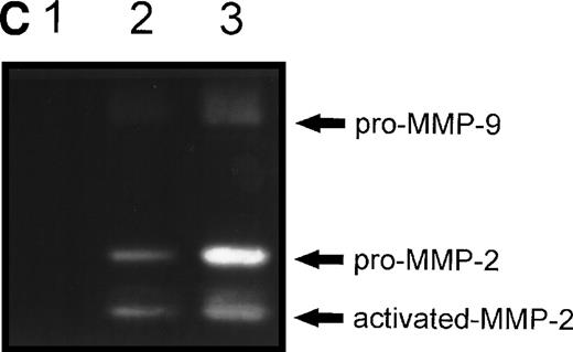 Fig. 6. (A) Changes in fibronectin-induced MMP-2 and MMP-9 production achieved by manipulating integrin-mediated signal transduction pathways. 107 CEM cells were exposed to the above-described chemicals 30 minutes before exposure to fibronectin. Conditioned medium was obtained after 6 hours, concentrated, and subjected to gelatin zymography. Graph shows the variation in the intensity of the fibronectin-induced gelatinolytic signal induced by treatment with the different products and their simultaneous effect on cell adhesion, both expressed as a percentage of those obtained by fibronectin alone (labeled basal). (B) Intensity of MMP-2 and MMP-9 production induced by exposure to soluble or solid-phase fibronectin. 107 CEM cells were exposed to soluble (10 μg/mL) or solid-phase (plastic surfaces coated with 100 μg/mL) fibronectin for 24 hours. Conditioned media were concentrated and subjected to gelatin zymography. (C) Fibronectin-induced MMP-2 and MMP-9 production by cells transfected with a dominant negative mutant of Ha-Ras. 107CEM cells transfected with Ha-Ras-Asn 17, cloned in the dexamethasone-inducible vector pMMTV, were exposed to soluble fibronectin for 24 hours. Conditioned medium from transfected cells was concentrated and subjected to gelatin zymography. Lane 1 shows absence of gelatinolytic activity in conditioned medium from transfected cells stimulated with 0.5 μmol/L dexamethasone without exposure to fibronectin. Lanes 2 and 3 display gelatinolytic signals provided by conditioned medium from untreated transfected cells (lane 2) and from transfected cells treated with 0.5 μmol/L dexamethasone (lane 3), both exposed to fibronectin. (D) Effect of PI-3K, MEK-1/2, and p38 MAPK inhibition on fibronectin-induced MMP-2 and MMP-9 production. 2 × 107 CEM cells were preincubated with several very specific inhibitors of PI-3K (wortmannin), ERK-1/2 kinase (PD 98059), or p38 MAPK (SB 202190) for 30 minutes before exposure to soluble fibronectin at 10 μg/mL. Conditioned medium was obtained 6-hours later, concentrated, and subjected to gelatin zymography. The picture shows the gelatinolytic signals provided by conditioned medium from untreated cells exposed to fibronectin (lane 1), or pretreated with PD 98059 (lane 2), wortmannin (lane 3), or SB 202190 (lane 4).