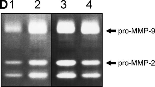 Fig. 6. (A) Changes in fibronectin-induced MMP-2 and MMP-9 production achieved by manipulating integrin-mediated signal transduction pathways. 107 CEM cells were exposed to the above-described chemicals 30 minutes before exposure to fibronectin. Conditioned medium was obtained after 6 hours, concentrated, and subjected to gelatin zymography. Graph shows the variation in the intensity of the fibronectin-induced gelatinolytic signal induced by treatment with the different products and their simultaneous effect on cell adhesion, both expressed as a percentage of those obtained by fibronectin alone (labeled basal). (B) Intensity of MMP-2 and MMP-9 production induced by exposure to soluble or solid-phase fibronectin. 107 CEM cells were exposed to soluble (10 μg/mL) or solid-phase (plastic surfaces coated with 100 μg/mL) fibronectin for 24 hours. Conditioned media were concentrated and subjected to gelatin zymography. (C) Fibronectin-induced MMP-2 and MMP-9 production by cells transfected with a dominant negative mutant of Ha-Ras. 107CEM cells transfected with Ha-Ras-Asn 17, cloned in the dexamethasone-inducible vector pMMTV, were exposed to soluble fibronectin for 24 hours. Conditioned medium from transfected cells was concentrated and subjected to gelatin zymography. Lane 1 shows absence of gelatinolytic activity in conditioned medium from transfected cells stimulated with 0.5 μmol/L dexamethasone without exposure to fibronectin. Lanes 2 and 3 display gelatinolytic signals provided by conditioned medium from untreated transfected cells (lane 2) and from transfected cells treated with 0.5 μmol/L dexamethasone (lane 3), both exposed to fibronectin. (D) Effect of PI-3K, MEK-1/2, and p38 MAPK inhibition on fibronectin-induced MMP-2 and MMP-9 production. 2 × 107 CEM cells were preincubated with several very specific inhibitors of PI-3K (wortmannin), ERK-1/2 kinase (PD 98059), or p38 MAPK (SB 202190) for 30 minutes before exposure to soluble fibronectin at 10 μg/mL. Conditioned medium was obtained 6-hours later, concentrated, and subjected to gelatin zymography. The picture shows the gelatinolytic signals provided by conditioned medium from untreated cells exposed to fibronectin (lane 1), or pretreated with PD 98059 (lane 2), wortmannin (lane 3), or SB 202190 (lane 4).