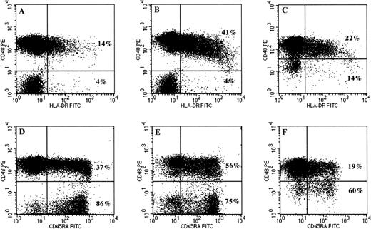 Fig. 2. Analysis of HLA-DR and CD45RA expression on normal (CD48+) and PNH (CD48−) components of peripheral blood T cells by three-color flow cytometry. Initial gating of T cells was based on low SSC characteristics and CD3 positivity as described in Materials and Methods and in Fig 1. The upper two-color dot plots (A through C) show the difference in HLA-DR expression between CD48+ and CD48− T cells in 3 representative patients with PNH. The percentage of normal and PNH T cells expressing HLA-DR are shown in the upper and lower quadrants, respectively. Not only is HLA-DR expression absent on GPI negative T cells (plots A and B), but also on T cells with partial GPI deficiency (plot C). The lower dot plots (D through F) show the differences in CD45RA expression by normal (CD48+) and PNH (CD48−) T cells. The proportion of naive T cells is much higher within the GPI-deficient compartment, independent of whether there is complete (plots D and E) or partial deficiency (plot F) of GPI-anchored proteins. The normal T-cell components have a predominantly memory (CD45RA−) phenotype.