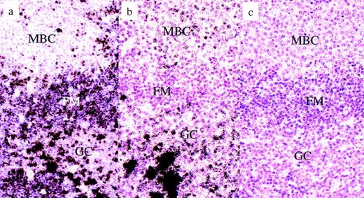 Fig. 3. Piringer’s lymphadeno- pathy. Radioactive in situ hybridization for the detection of Ig heavy chain gene transcripts. (a) Igμ in situ hybridization, antisense: the vast majority of the monocytoid B cells are negative, whereas resting mantle B cells are clearly labeled. Some plasma B cells in the germinal center display extremely intensive labels. (b) Igγ in situ hybridization, antisense: most monocytoid B cells are weakly labeled, whereas mantle B cells are completely negative. Some germinal center B cells display a moderate labeling, whereas others are very intensely labeled (plasma cells). (c) Igγ in-situ hybridization, sense: negative control. No cells are labeled. MCB, monocytoid B cells; FM, follicle mantle; GC, germinal center.