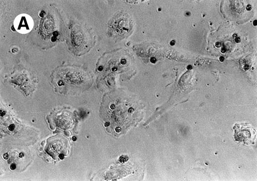 Fig. 2. (A) Representative experiment demonstrating that IL-1 stimulation (10−10 mol/L) increased the percentage of SAEC that ingested apoptotic eosinophils; (B) together with their capacity to ingest multiples of aged eosinophils. Each bar represents the mean ± SEM of 4 separate experiments in which the number of ingested aged eosinophils inside 200 resting or cytokine-stimulated SAEC were counted.