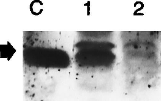 Fig. 4. Effect of PAO on the production of mature IL-1β by OCIM2 cells. Cells were incubated in the presence and absence of 0.1 μmol/L PAO. The amount of mature IL-1β protein produced by these cells was then assessed by Western immunoblotting. The arrow points to the 17.5-kD mature IL-1β protein. Lane C shows control mature IL-1β protein, lane 1 shows protein from cells incubated in tissue culture media with DMSO, and lane 2 shows protein from cells incubated with PAO.