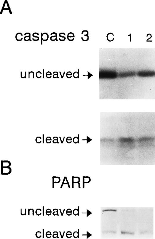 Fig. 8. Effect of PAO on caspase 3 and PARP cleavage. OCIM2 cells were incubated without PAO (lane C) and with it at a concentration of 0.08 μmol/L (lane 2) or 0.1 μmol/L (lane 1) for 8 hours. Cleavage of caspase 3 was already detected after 4 hours. Increments in the levels of cleaved caspase 3 (A) and cleaved PARP (B) are depicted.