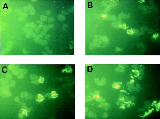 Fig. 6. Induction of apoptosis by PAO. OCIM2 cells were incubated in the absence (A) and presence of PAO for 4 (B), 6 (C), and 8 (D) hours. Apoptotic cells appear yellow.