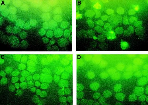 Fig. 9. Effect of Z-DEVD-FMK on PAO-induced apoptosis. OCIM2 cells were incubated for 6 hours without any drug (A), with 0.1 μmol/L of PAO (B), with 50 μmol/L of Z-DEVD-FMK (C), and with both PAO and Z-DEVD-FMK (D). Apoptotic cells appear yellow.