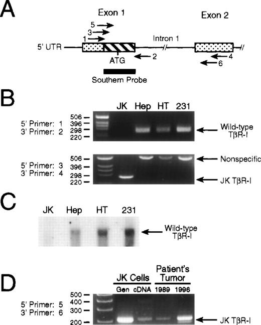 Fig. 4. Genomic analysis of TβR-I in JK cells. (A) Schematic depicting the PCR primers and Southern blotting probe used to analyze the intron-exon structure surrounding exons 1 and 2 of the TβR-I gene. Shown is exons 1 and 2 of TβR-I (stippled boxes) and their intervening intron. The hatched box of exon 1 represents the 178-bp deletion identified by RT-PCR analysis of JK cell mRNA, and the thick bar underlying this region depicts the 32P-radiolabeled PCR fragment used in Southern blotting experiments. Amplification of exon 1 from genomic DNA was accomplished using primer pair 1 and 2 to amplify the normal 255-bp product. Exon 1 and 2 initiated amplification across intron 1 was accomplished using primer pair 3 and 4 or primer pair 5 and 6 on genomic DNA obtained from cultured cells or patient biopsies, respectively. Primer sequences and PCR reaction conditions are described in Materials and Methods. (B) PCR of genomic DNA identifies an ∼5 kb deletion in JK cell TβR-I gene. (Upper panel) A total of 100 ng of genomic DNA from JK, HepG2 hepatoma (Hep), HT1080 fibrosarcoma (HT), or MDA-MB-231 breast cancer (231) cells was subjected to PCR amplification using primer pair 1 and 2 that flanked exon 1 of the human TβR-I. The resulting PCR products were fractionated through a 2.5% agarose/TAE gel as described in Materials and Methods. Data shown is a representative picture of an ethidium bromide-stained gel demonstrating the presence of the 255-bp TβR-I product only in TGF-β–responsive cells. (Lower panel) One microgram of genomic DNA from JK, HepG2 (Hep), HT1080 (HT), or MDA-MB-231 (231) cells was subjected to PCR amplification using primer pair 3 and 4, which flanked the 178-bp deletion in the JK cell TβR-I cDNA. Shown is a representative picture of an ethidium bromide-stained gel demonstrating the presence only in JK cells of a single amplified PCR product, whose size (260 bp) and sequence was identical to that of the JK cell TβR-I cDNA. (C) Radiolabeled deletion fragment fails to hybridize with JK cell genomic DNA. Ten micrograms of genomic DNA from JK, HepG2 (Hep), HT1080 (HT), or MDA-MB-231 (231) cells was digested overnight at 37°C with Hind III, and after transfer to nylon membrane, hybridized with a 32P-radiolabeled probe corresponding to the 178-bp sequence absent in JK cell TβR-I cDNA as described in Materials and Methods. Data shown is a representative autoradiograph demonstrating the presence of a hybridizing signal in the genomes of TGF-β–responsive cells, but not in JK cells. (D) Detection of mutated TβR-I in tumor biopsies obtained before establishment of the JK cell line. JK cell genomic DNA (Gen), cDNA, or genomic DNA obtained from patient tumor biopsies performed in 1989 and 1996 were subjected to PCR amplification using primer pair 5 and 6, which flanked the 178-bp deletion in the JK cell TβR-I cDNA. Shown is a representative picture of an ethidium bromide-stained gel demonstrating the presence of mutated TβR-I gene in the patient’s primary tumor samples before the establishment of the JK cell line.