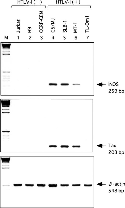 Fig. 1. Detection of hiNOS mRNA in Tax-expressing T-cell lines infected with HTLV-I by RT-PCR analysis. RT of cellular RNA (1 μg total RNA) and PCR were performed. One tenth of the PCR mixture was analyzed by ethidium bromide staining of 2% agarose gel. Agarose gel electrophoresis of DNA amplified by hiNOS, Tax, and β-actin primers. M: size markers. The band of specific mRNA for hiNOS is 259 bp, Tax of HTLV-I is 203 bp, and β-actin as internal control is 548 bp. The three T-cell lines, Jurkat, H9, and CCRF-CEM, are negative for HTLV-I. Other T-cell lines are positive for HTLV-I. Arrows indicate the position of the specifically amplified DNA.