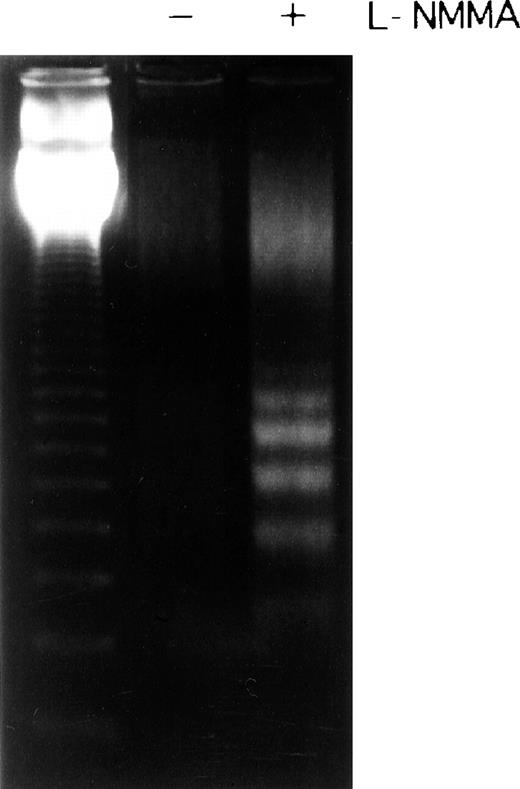 Fig. 9. Effect of NO on apoptosis in an HTLV-I–infected T-cell line. C5/MJ cells were incubated for 72 hours in the presence (+) or absence (−) of L-NMMA (1 mmol/L). Cellular DNA was prepared and resolved by electrophoresis on a 2% agarose gel.