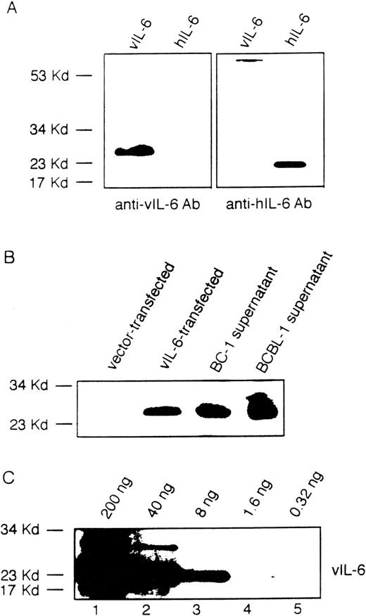 Fig. 2. Viral IL-6 in the culture supernatants of BCBL-1 and BC-1 cells detected by immunoblotting with a specific rabbit antiserum. (A) A rabbit antiserum to vIL-6 was used in immunoblotting of viral and human IL-6 protein. (B) Conditioned medium from the BCBL-1 and BC-1 cell lines (1 mL) was TCA-precipitated and then analyzed by immunoblotting with a rabbit antiserum to vIL-6. Cell lysates from NIH3T3 cells (1 × 103 cells) transfected with a control vector or with the vIL-6 gene were used as controls. (C) Detection of purified recombinant vIL-6 (0.32 to 200 ng) in immunoblotting using a rabbit antiserum to vIL-6.