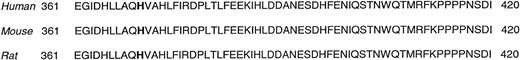 Fig. 2. The human, mouse, and rat amino acid sequence surrounding the amino acid mutated in the patient, histidine 370. The mutated amino acid is shown in bold type. The 3 sequences are identical in this region and extending all the way to amino acid 475.